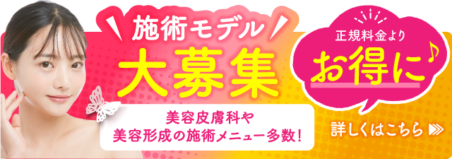 施術モデル大募集　正規料金よりお得に