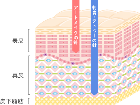 アートメイクと刺青の違い