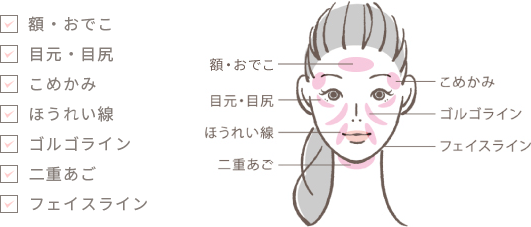 施術可能な箇所 額・おでこ・目元・目尻・こめかみ・ほうれい線・ゴルゴライン・二重あご・フェイスライン