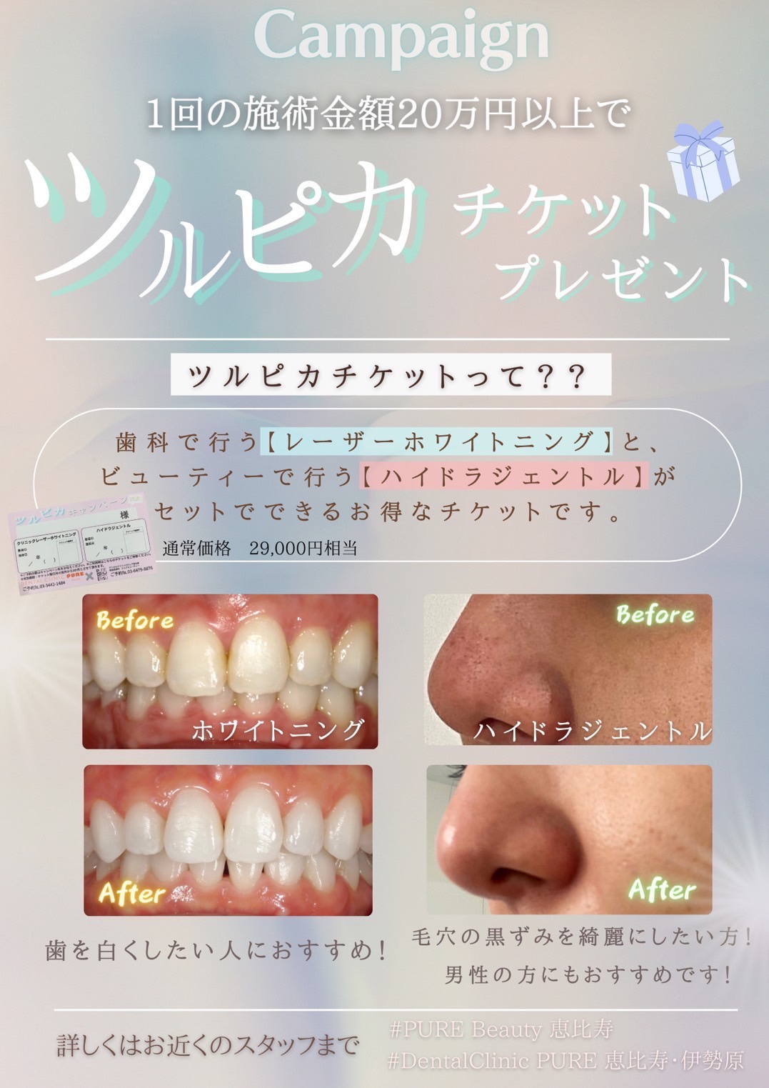 ツルピカキャンペーン