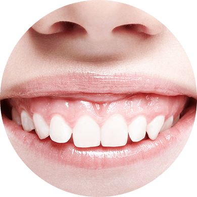 ガミースマイル