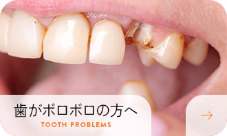 歯がボロボロの方へ