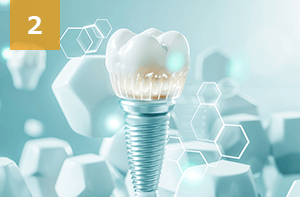 インプラント経験25年以上 累計症例数30,000人以上の実績