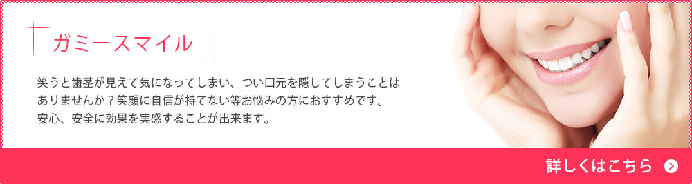 ガミースマイル