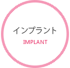 インプラント