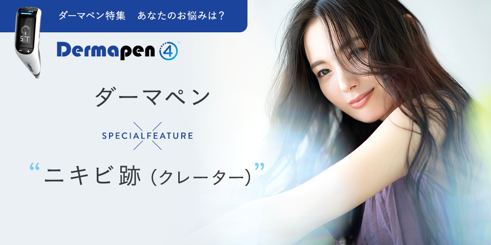 ダーマペン特集　あなたのお悩みは？　ダーマペン×ニキビ跡(クレーター)